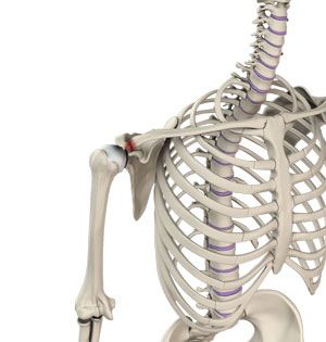 Acromioclavicular (AC) Joint Reconstruction