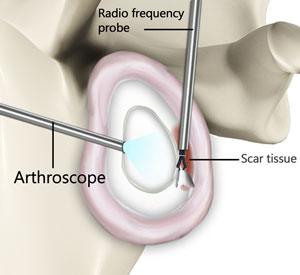 shoulder-anatomy