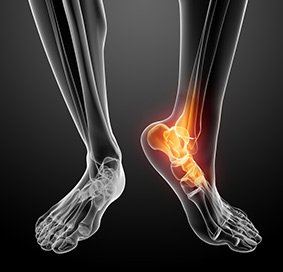 Non-Surgical Treatment for Foot and Ankle Pain