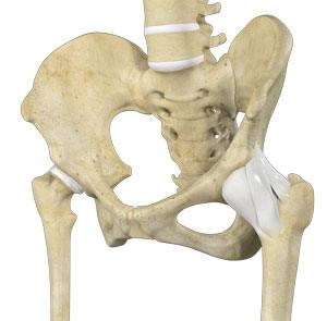 Hip Ligament Injuries