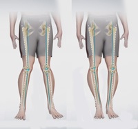 Knee Angular Deformities