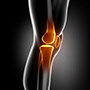 Short-Stay and Fast-Track Knee Replacement