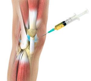 Orthobiologics for the Knee