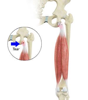 shoulder-anatomy