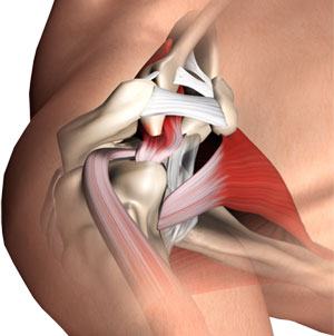 Subacromial Decompression